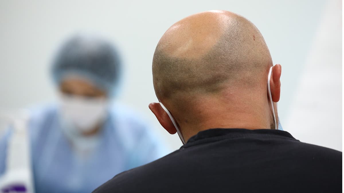 Как протекает оспа обезьян и насколько она опасна