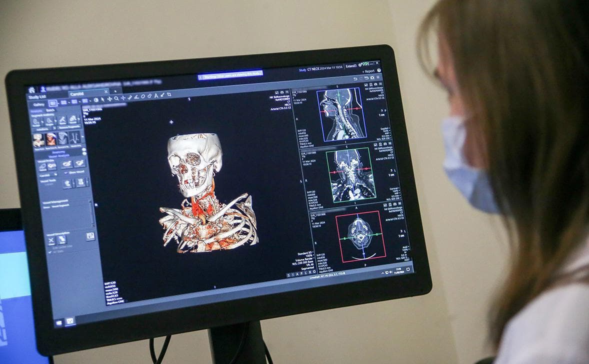 Как профилактика меняет борьбу с главной причиной смертности в России