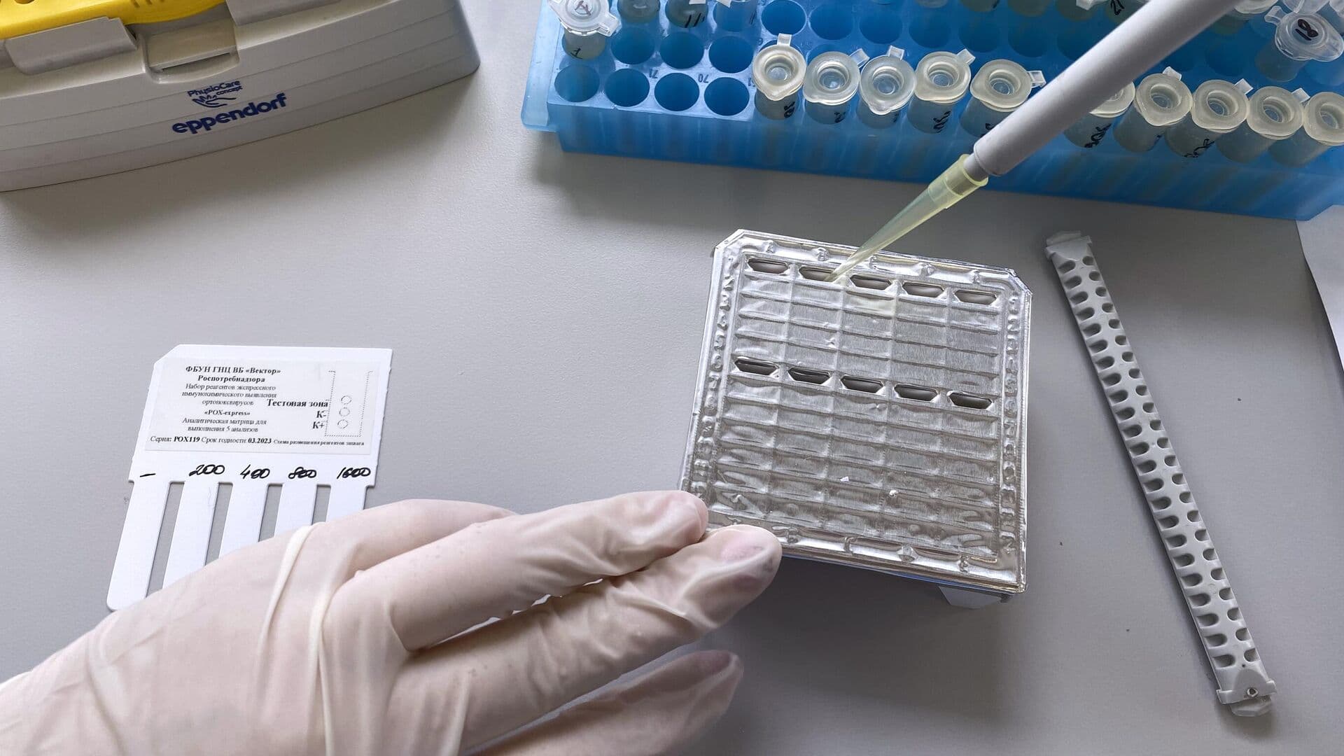 Роспотребнадзор оценил риски завоза оспы обезьян в Россию