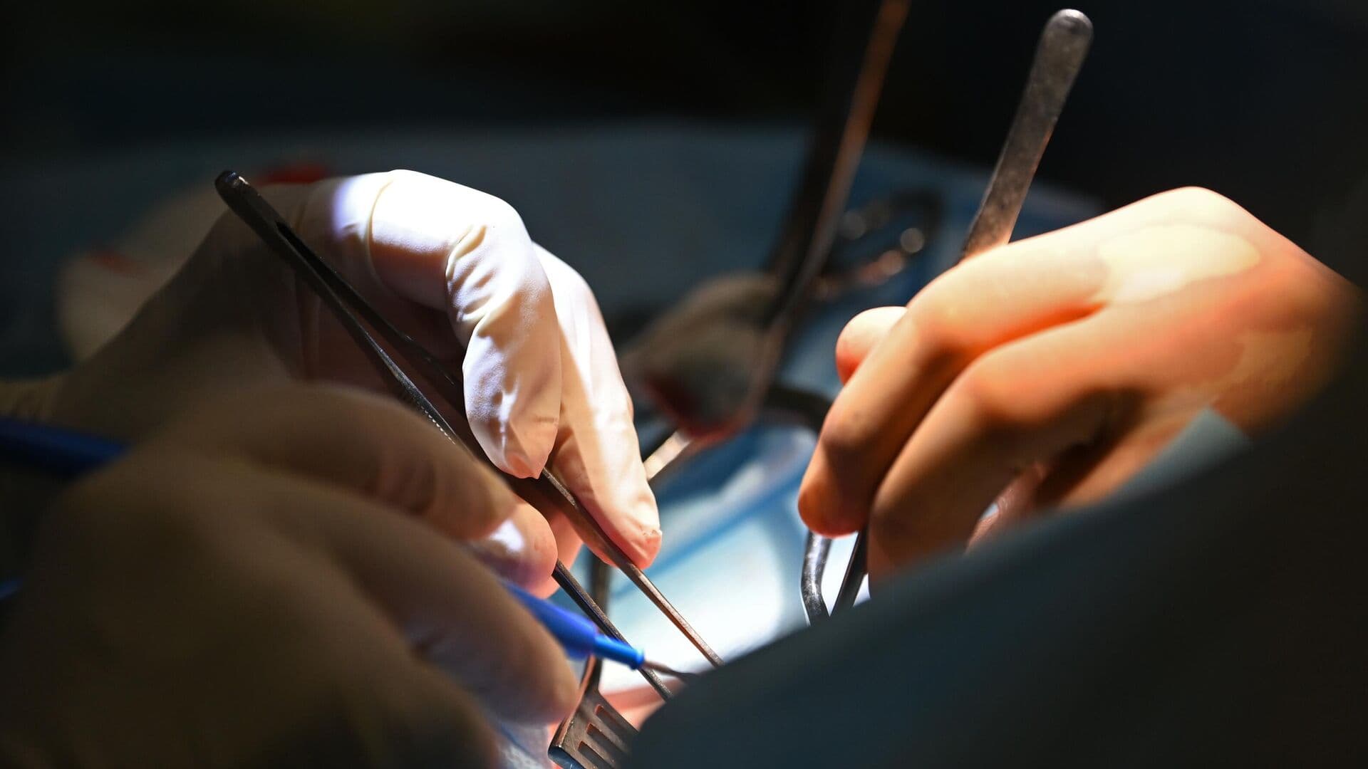 В России зарегистрировали робота для малоинвазивной хирургии