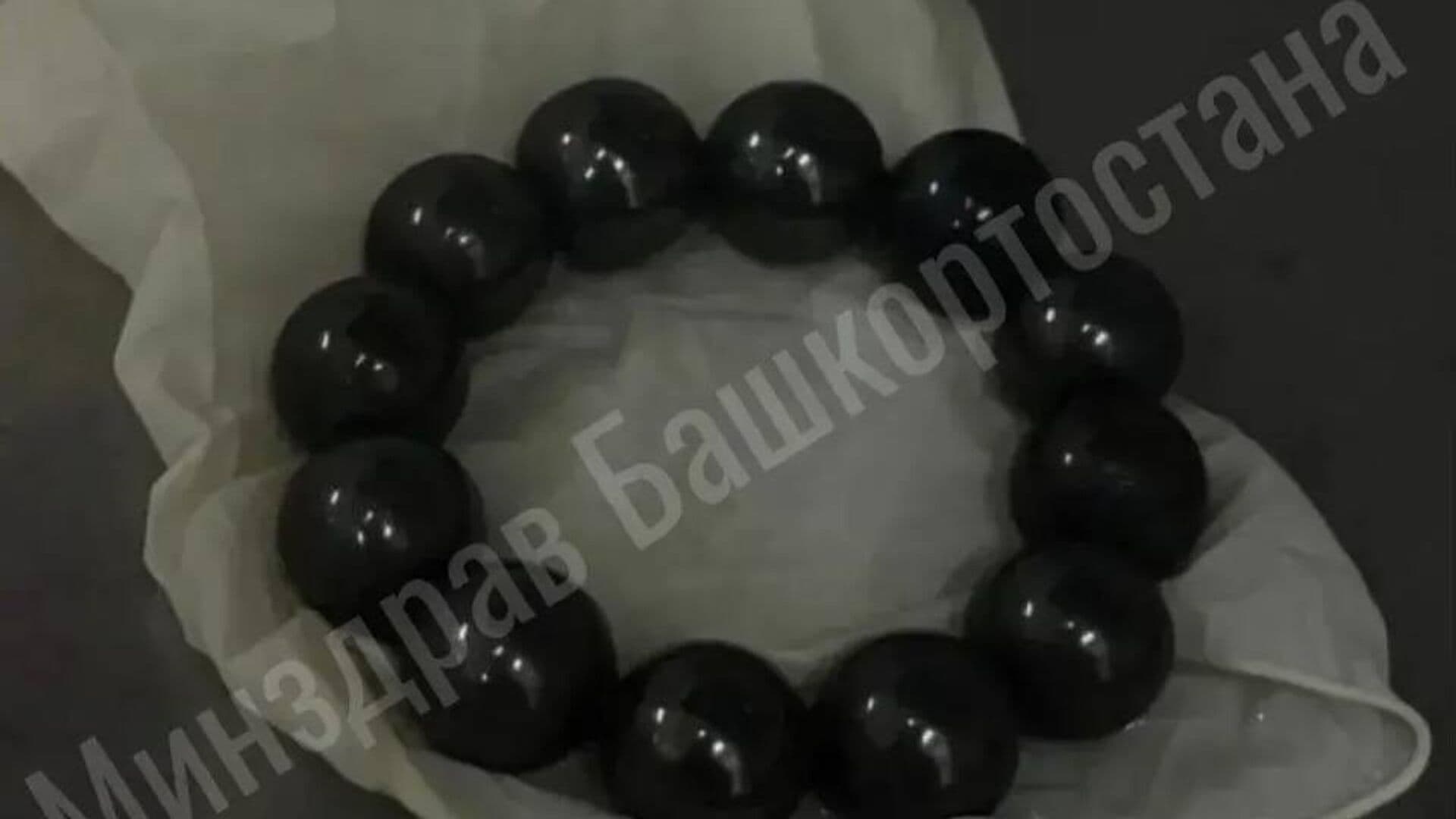 В Башкирии хирурги спасли девочку, проглотившую 12 магнитных шариков