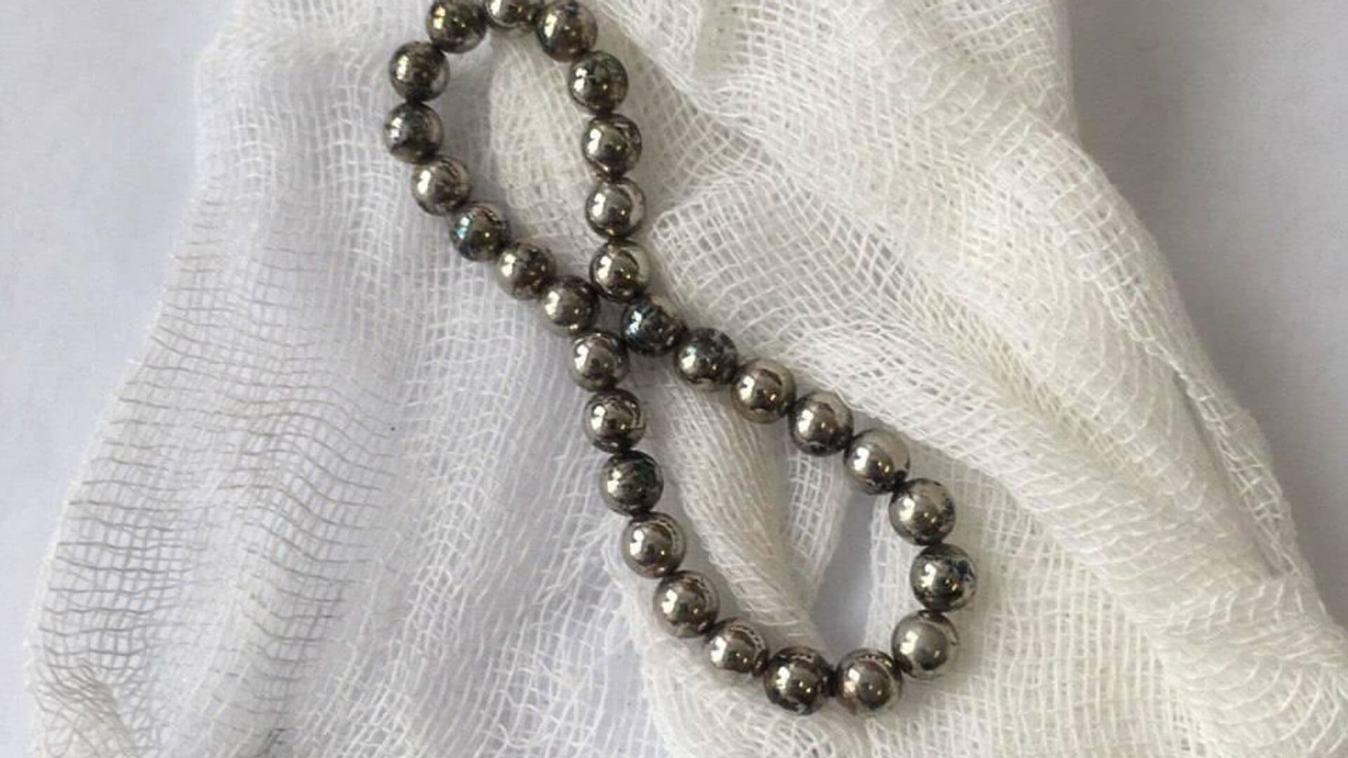 В Подмосковье врачи спасли девочку, проглотившую магнитные шарики