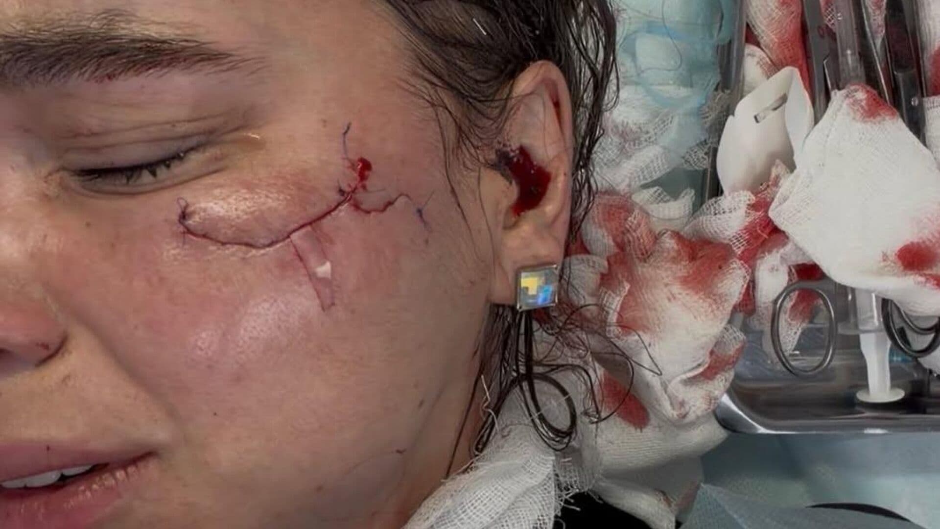 В Казани королеве красоты из Кирова изуродовали лицо в клубе