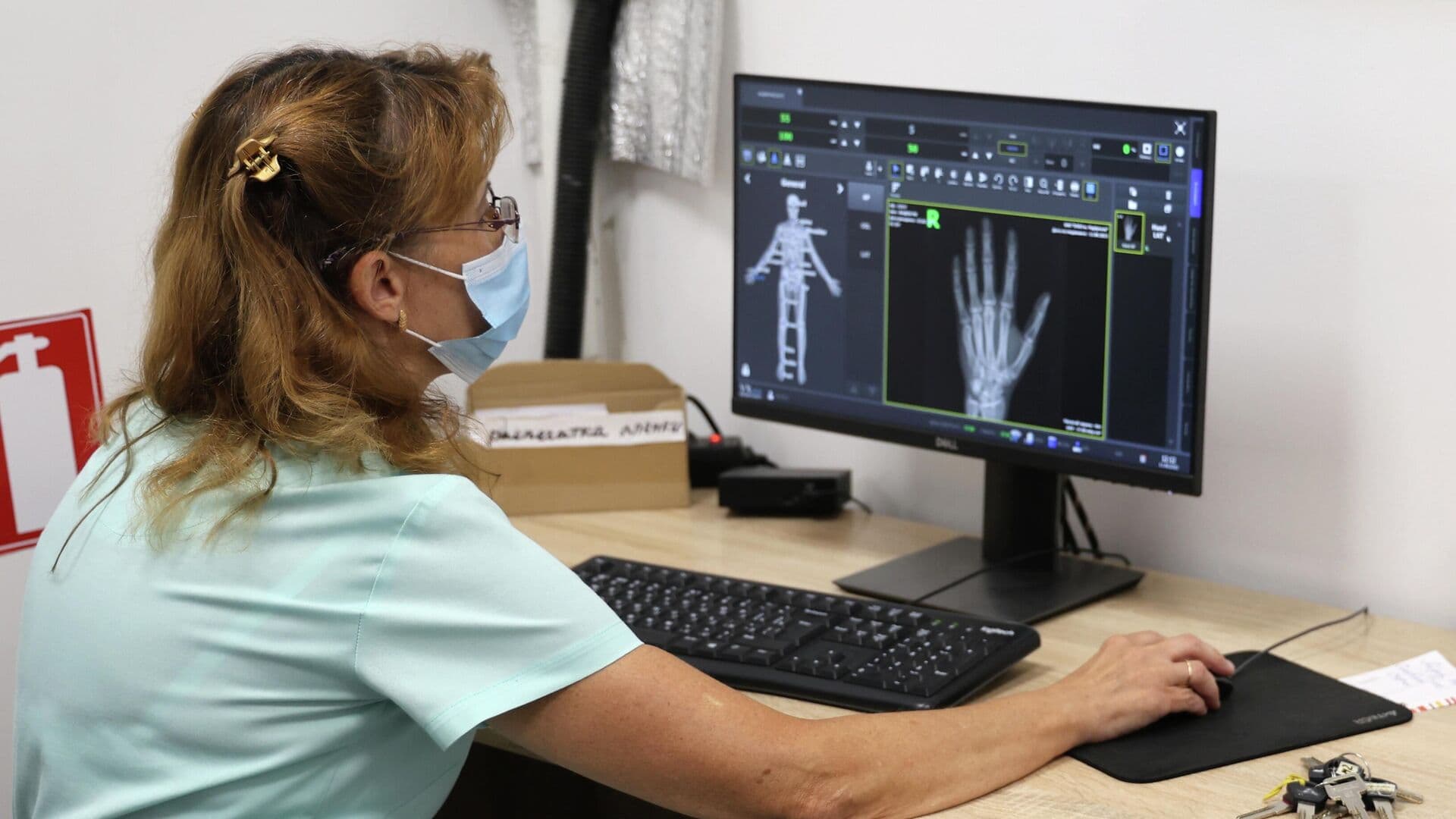 В Приморье врачи извлекли из руки пациентки стеклянную иглу