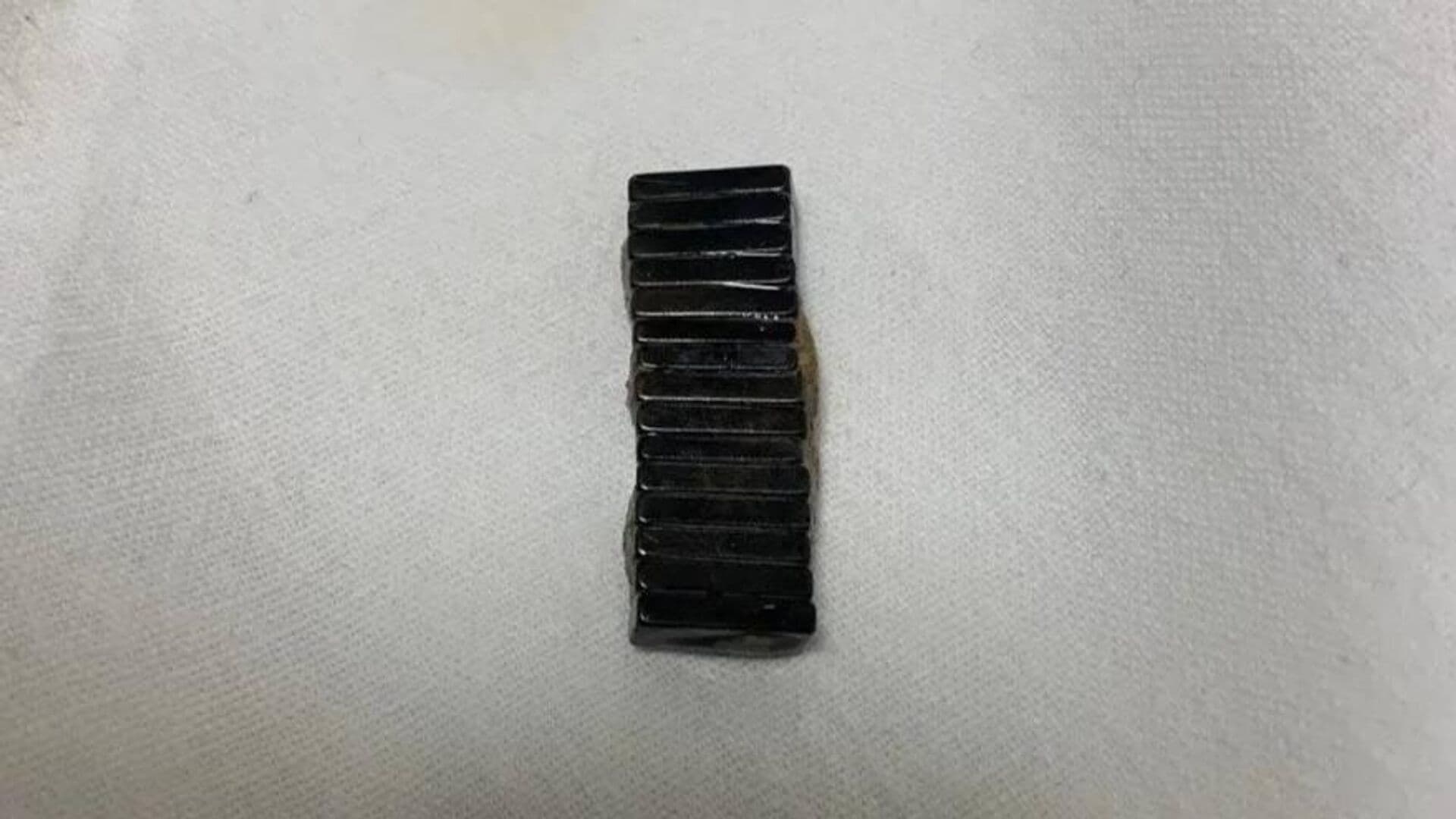 В Подмосковье врачи спасли девочку с 20 магнитами в кишечнике