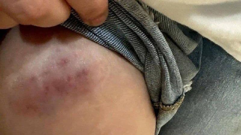 В Ростове-на-Дону обезьяна напала на девочку