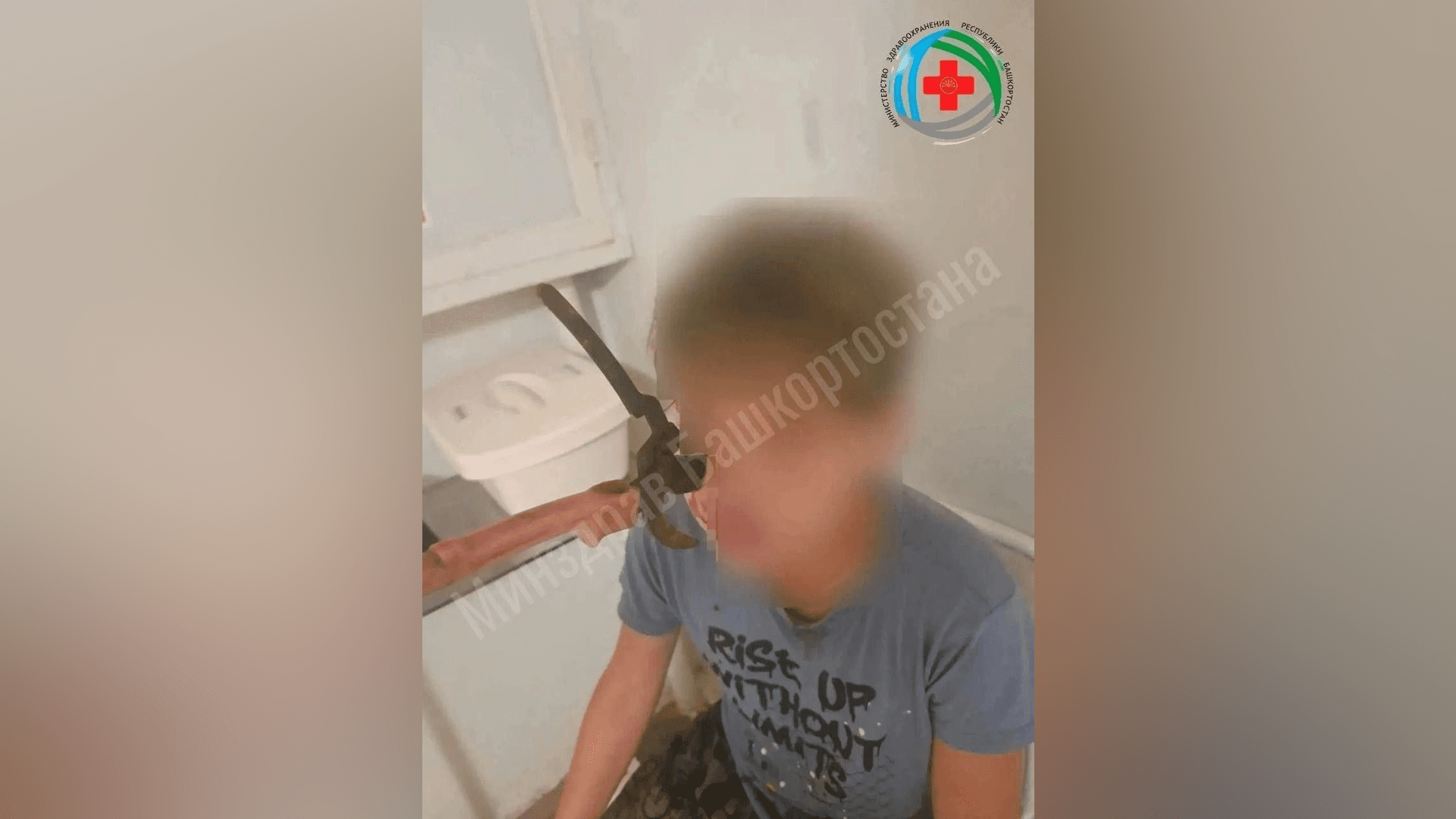 В Башкирии садовый секатор впился подростку в щеку