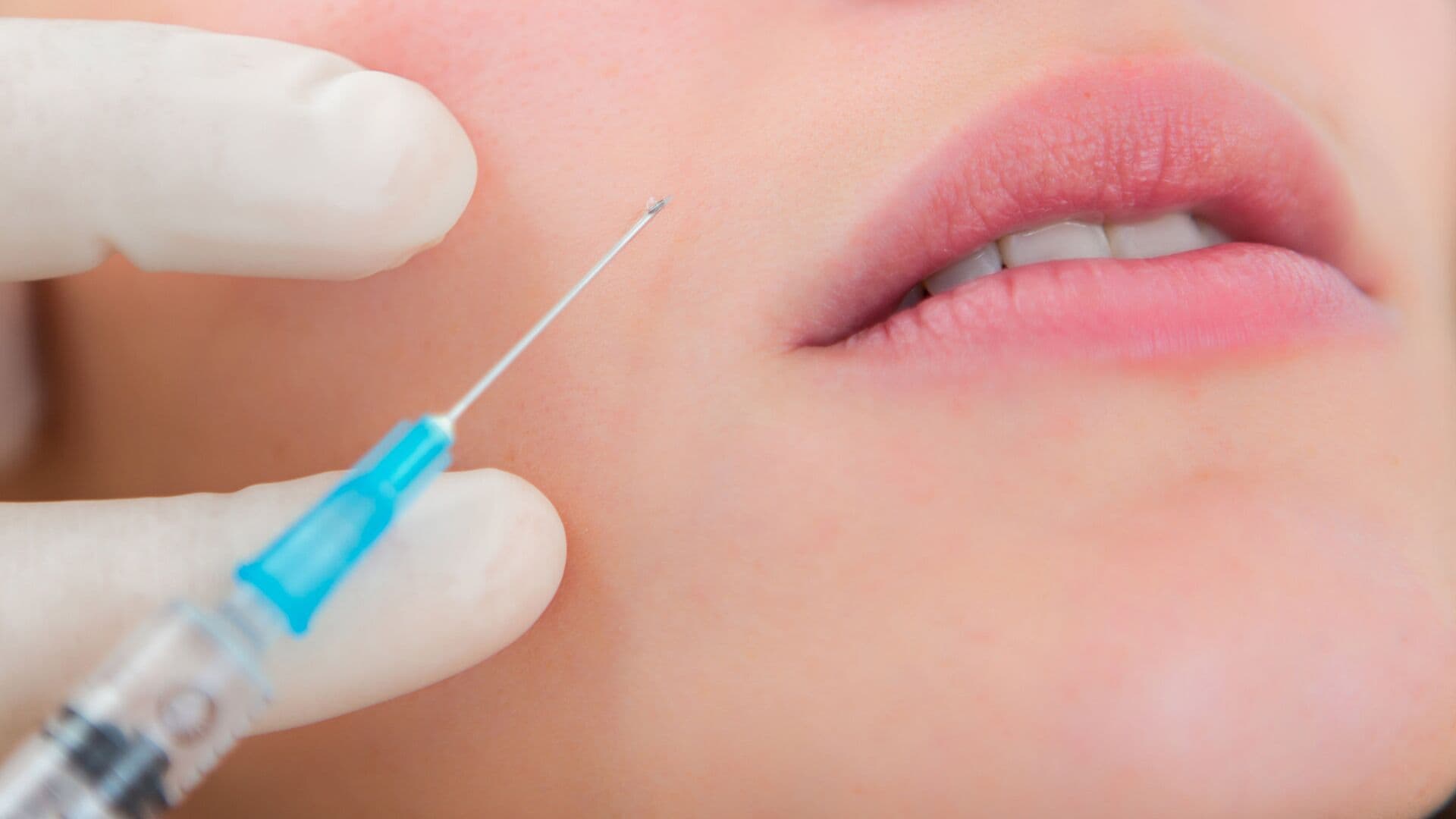 Эксперт рассказала, нужны инъекции ботокса для профилактики морщин