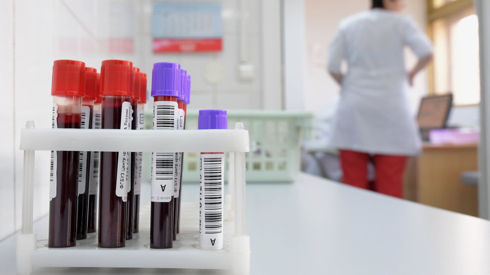 Роспотребнадзор проводит эпидрасследование инфекции в детсаду в Подмосковье