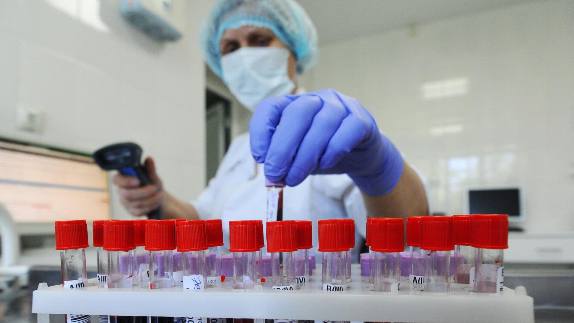 Уровень заболеваемости ВИЧ в России снизился до исторического минимума