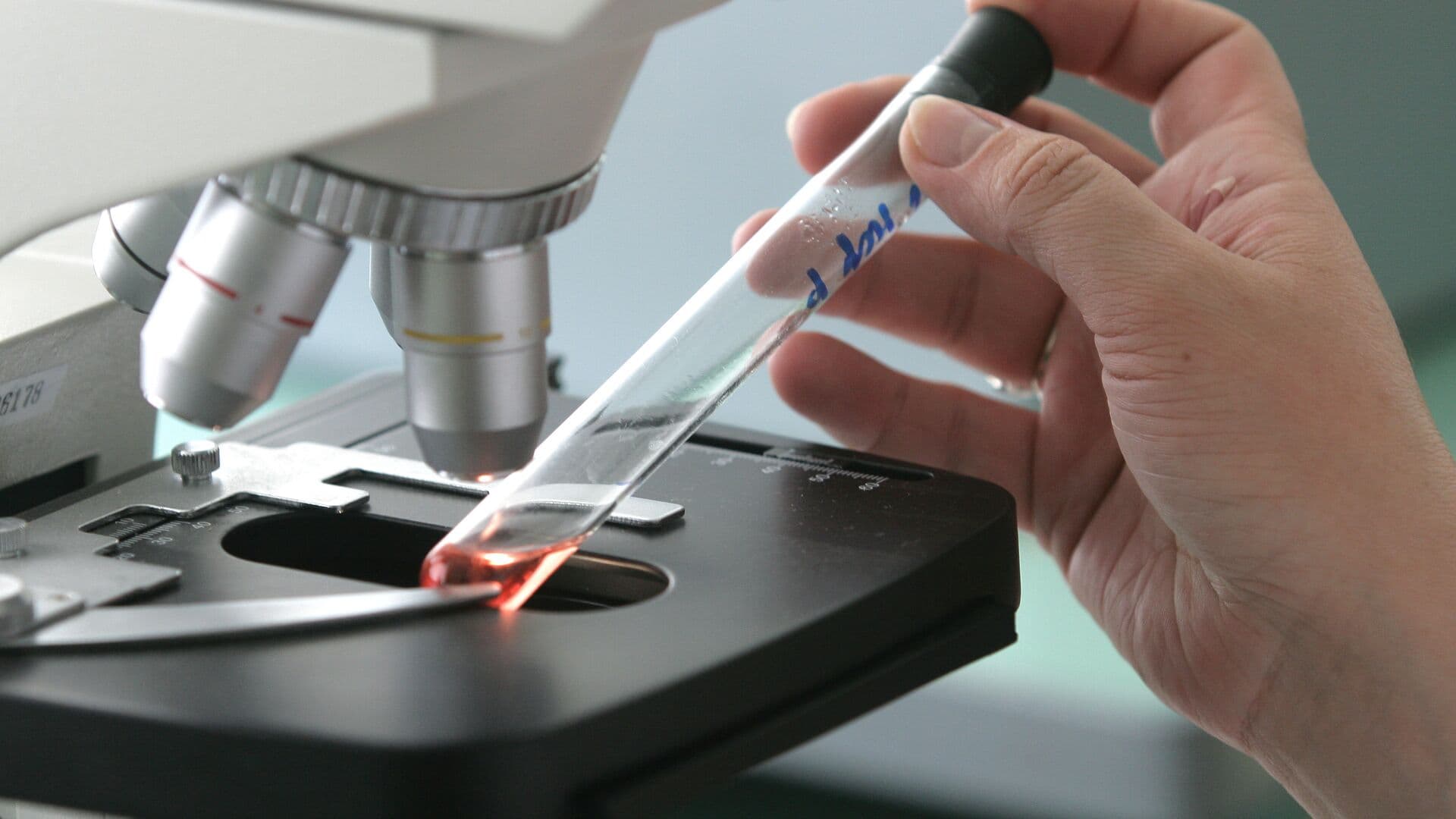 Установлено, что вирус рыб вызывает серьезные заболевания глаз у людей